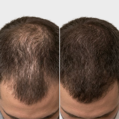 Soullix - ScalpEssence